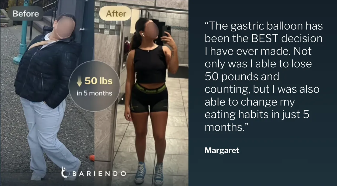 Foto del antes y después de Margaret, paciente de balón gástrico que perdió 50 libras