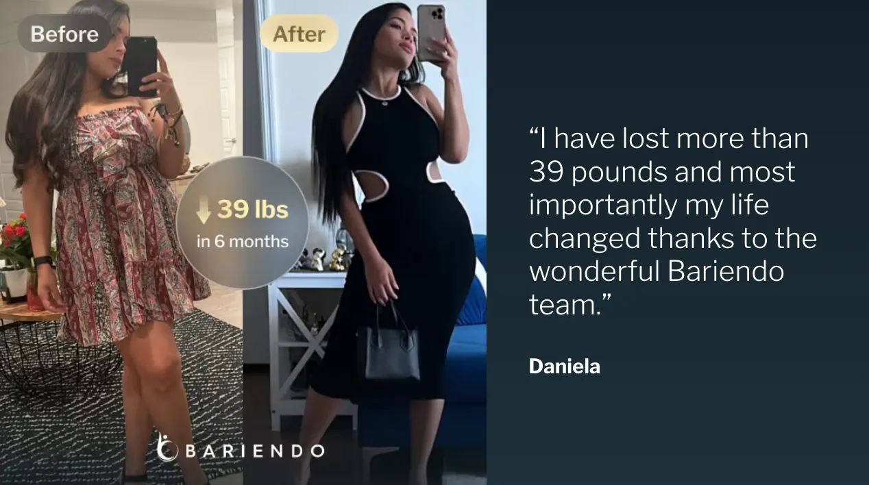 Fotos del antes y después de Daniela, paciente de balón gástrico que perdió 39 libras