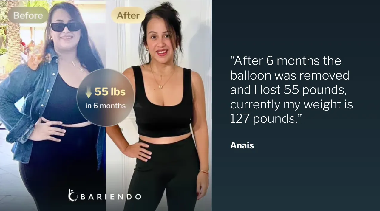 Fotos del antes y después de Anais, paciente de balón gástrico que perdió 55 libras