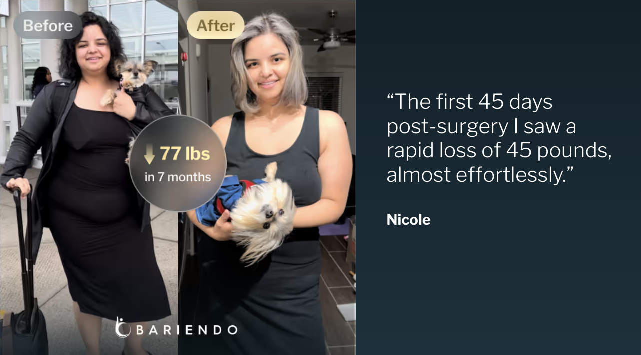 Before and after photos of Nicole, who lost 77 pounds in 7 months with ESG Stomach Tightening, beside her testimonial quote