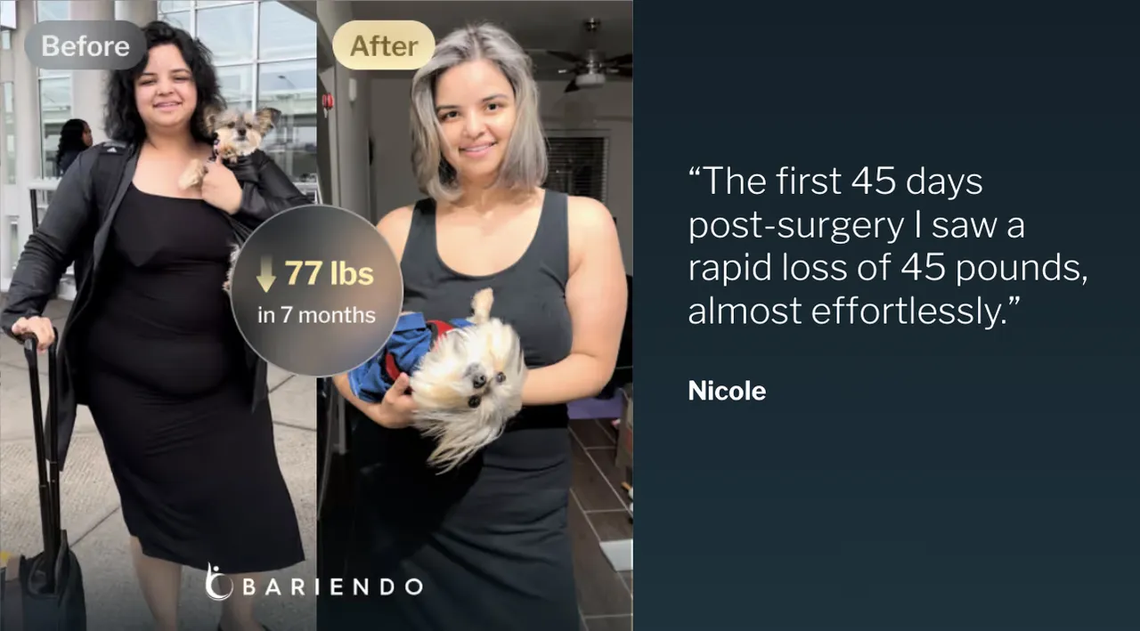 Before and after photos of Nicole, who lost 77 pounds in 7 months with ESG Stomach Tightening, beside her testimonial quote