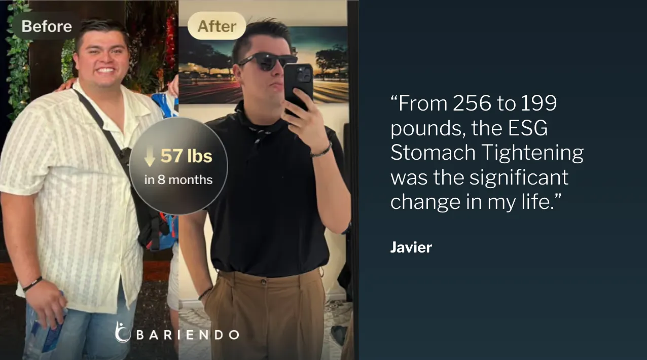 Before and after photos of Javier, who lost 57 pounds in 8 months with ESG Stomach Tightening, beside his testimonial quote