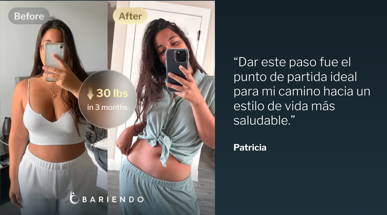Fotos del antes y después de Patricia, quien perdió 30 libras en 3 meses con la Reducción de Estómago ESG, junto a su testimonio
