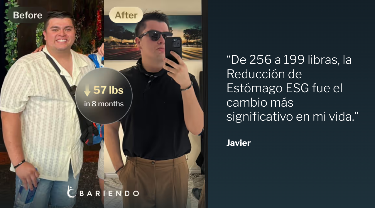 Fotos del antes y después de Javier, quien perdió 57 libras en 8 meses con la Reducción de Estómago ESG, junto a su testimonio