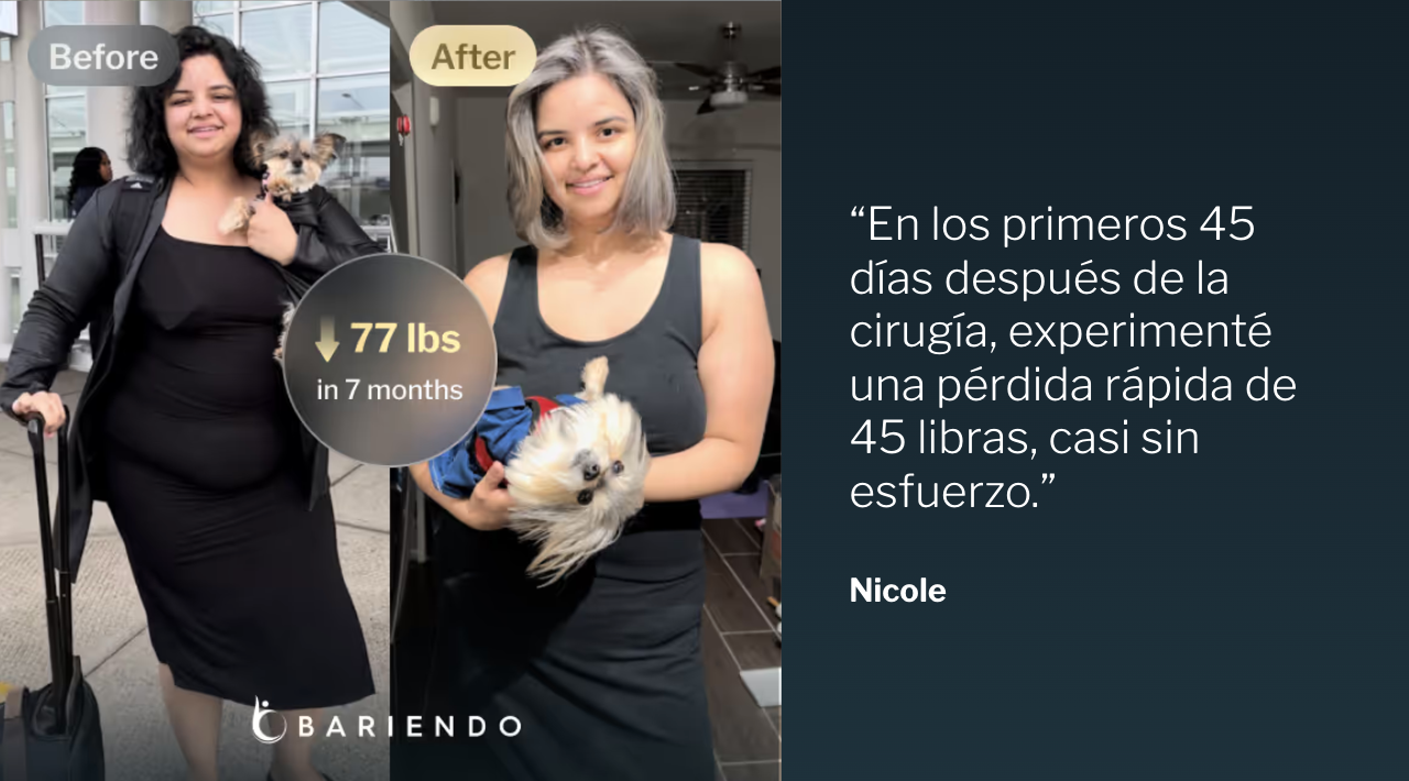 Fotos del antes y después de Nicole, quien perdió 77 libras en 7 meses con la Reducción de Estómago ESG, junto a su testimonio