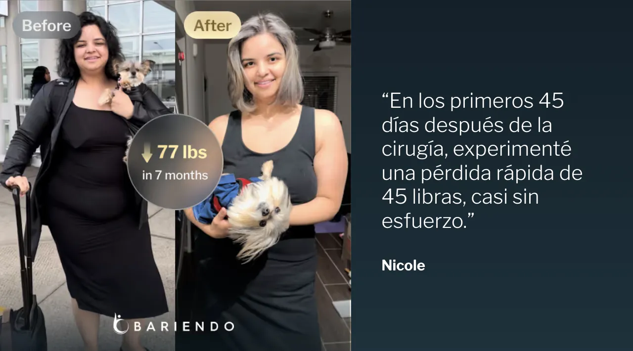 Fotos del antes y después de Nicole, quien perdió 77 libras en 7 meses con la Reducción de Estómago ESG, junto a su testimonio