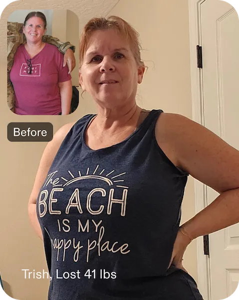 Trish, una mujer que perdió 41 libras después de someterse a ESG, sonriendo y de pie con confianza en ropa casual, mostrando sus resultados de pérdida de peso.