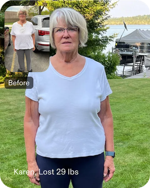 Before and after photos of Karen, an Everself patient who lost 29 pounds after gastric sleeve surgery