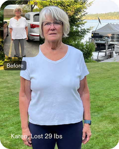 Before and after photos of Karen, an Everself patient who lost 29 pounds after gastric sleeve surgery