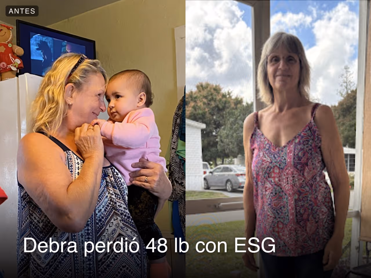 Debra ES