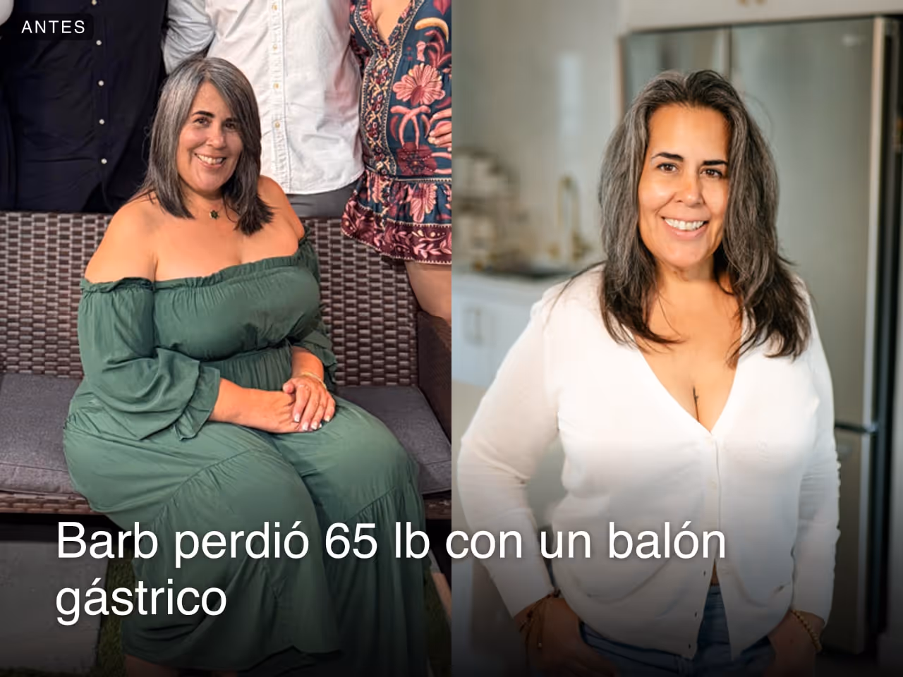 Imagen de antes y después de Barb, quien perdió 65 libras en 10 meses con balón gástrico