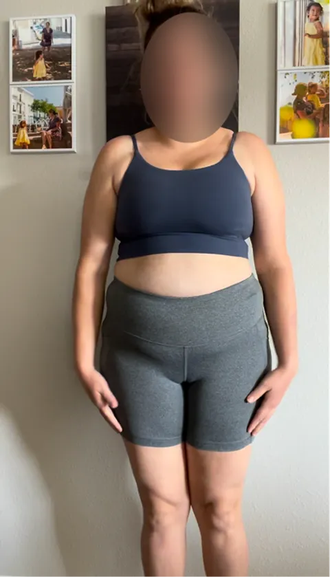 Iris before a gastric balloon