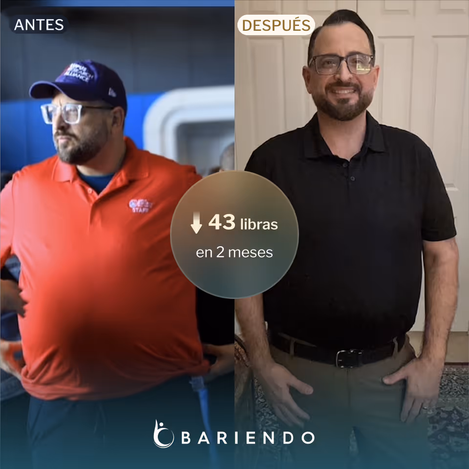 Joey lost 43 lbs with an ESG with Everself