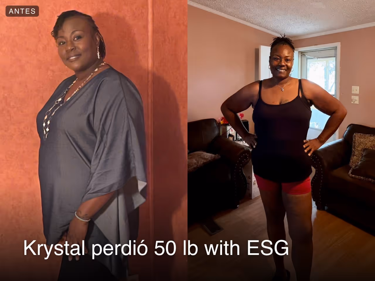 Imagen de antes y después de Krystal, quien perdió 50 libras en 6 meses with ESG