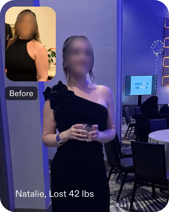 Before and after images of Natalie who lost 42 pounds in 7 months after a ESG procedure with Everself
