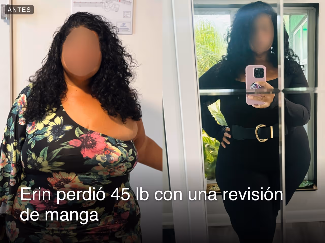 Imágenes de antes y después de Erin, quien perdió 45 libras en 3 meses después de una revisión de gastrectomía en manga - SIS con Everself