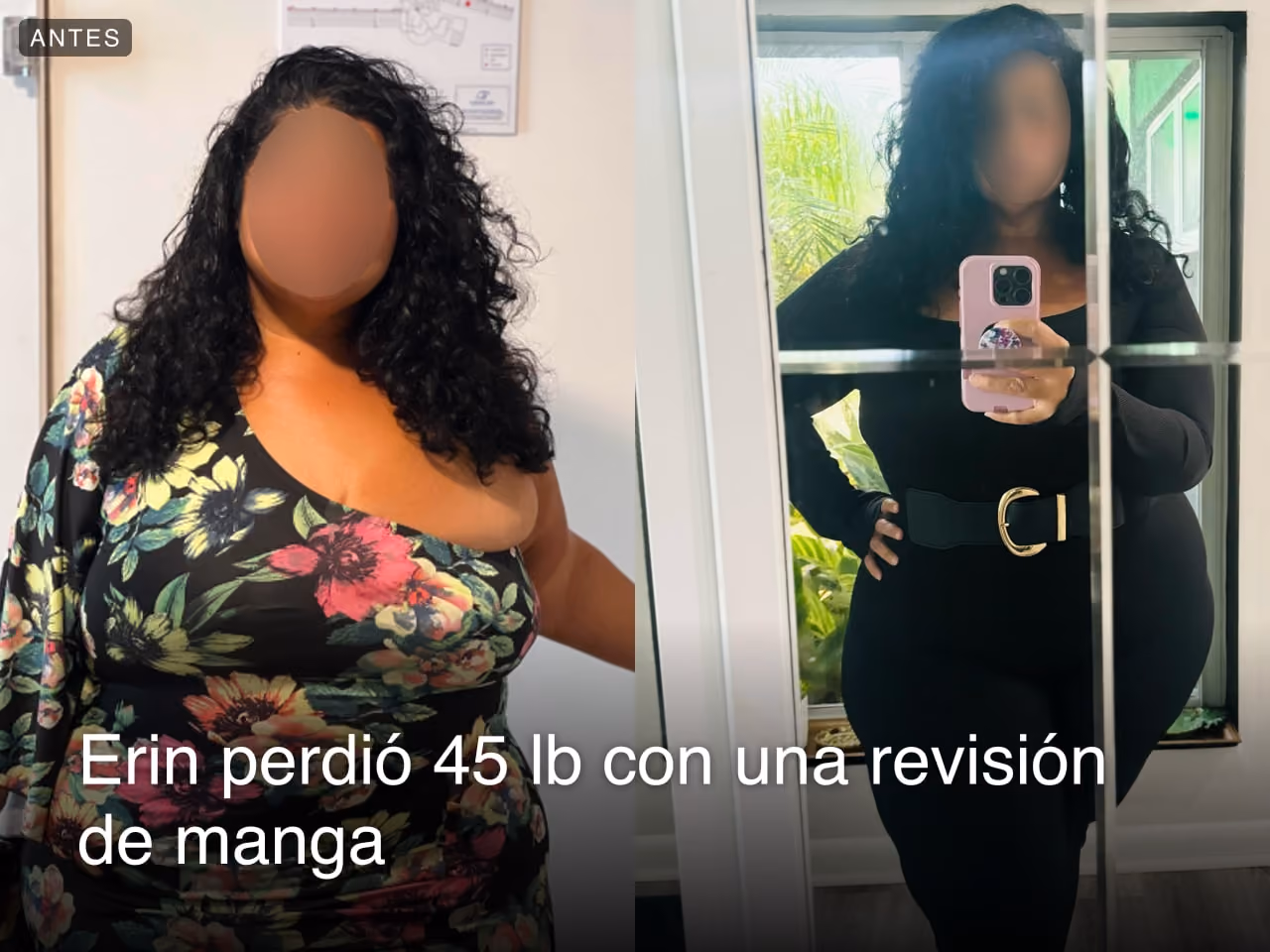 Imágenes de antes y después de Erin, quien perdió 45 libras en 3 meses después de una revisión de gastrectomía en manga - SIS con Everself