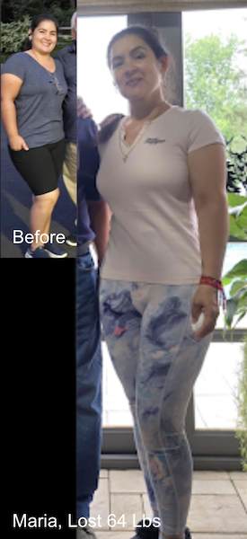Before and after image of Maria who lost 64 lbs in 12 months with ESG
