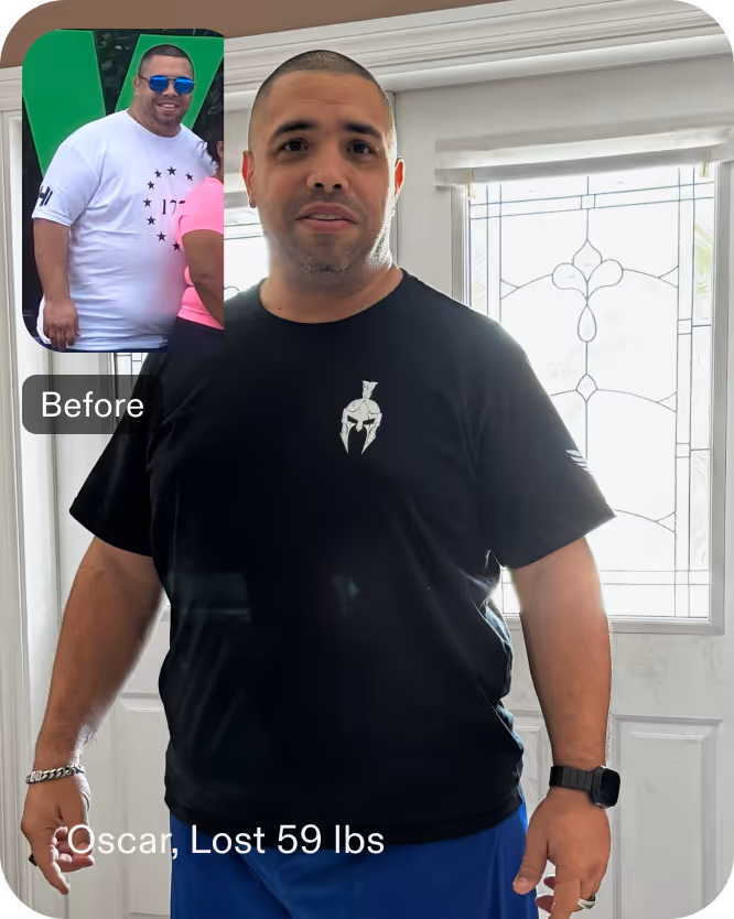 Before and after images of Oscar who lost 59 pounds in 6 month through Everself's ESG Stomach Tightening® procedure