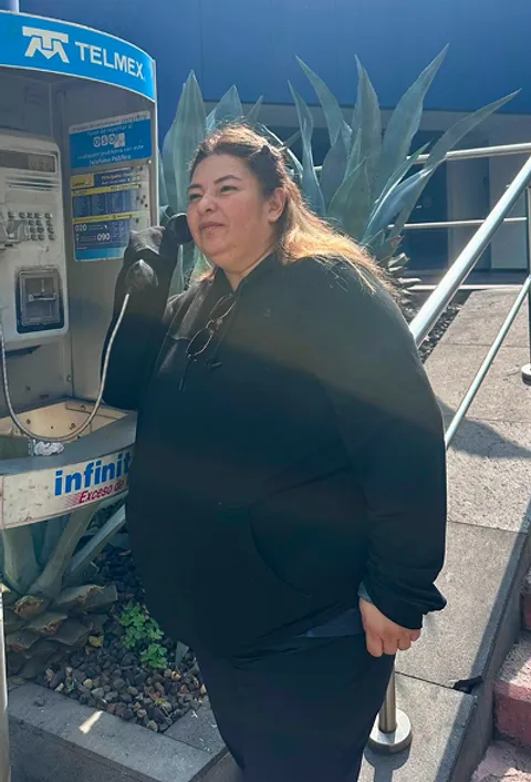 Doris before ESG Stomach Tightening