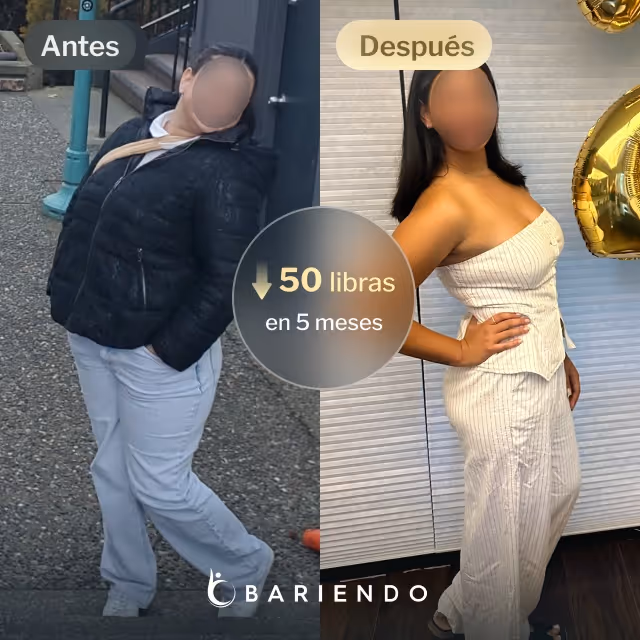 Imágenes de antes y después de Margarett, una paciente de balón gástrico en Everself, quien perdió 50 libras en 5 meses