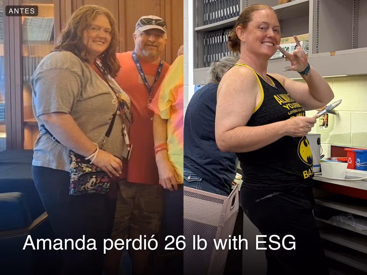Imagen de antes y después de Amanda, quien perdió 26 libras en 4 meses con ESG