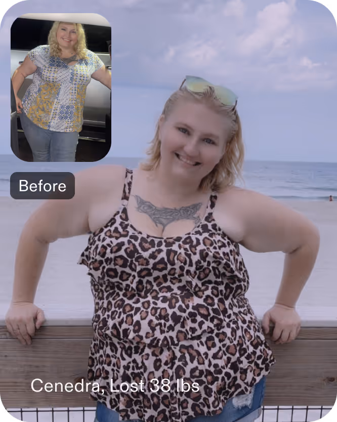 Cenedra lost 38 lbs in 5 months after an ESG procedure with Everself