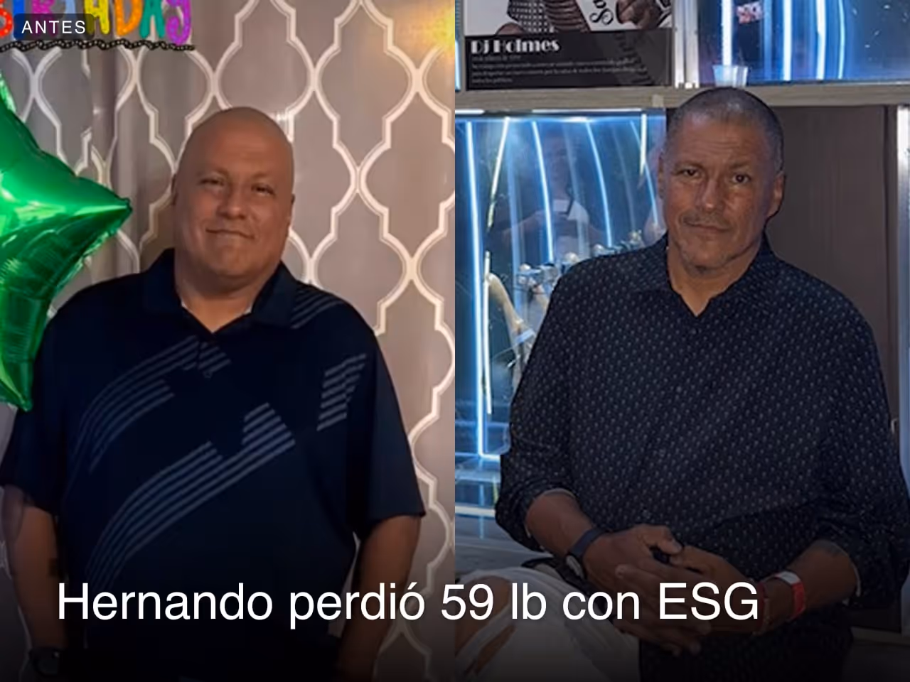 Imágenes de antes y después de Hernando, quien perdió 59 libras en 3 meses tras un procedimiento ESG con Everself