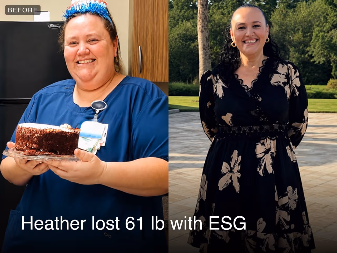 Before and after image of Heather who lost 61 lbs in 5 months with ESG