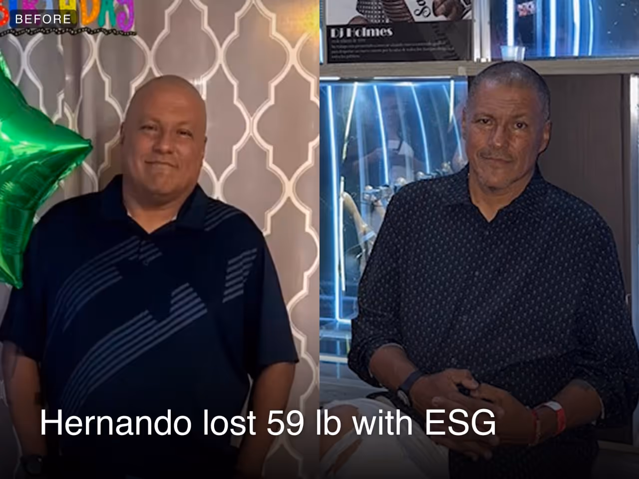 Before and after images of Hernando who lost 59 pounds in 3 months after a ESG procedure with Everself