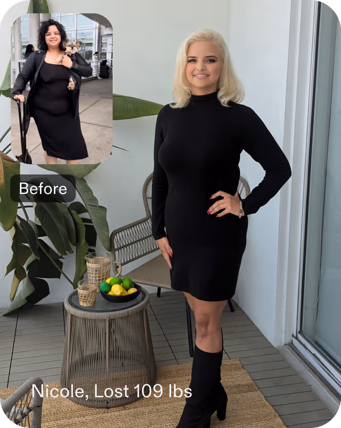 Before and after images of Nicole, a Everself ESG Stomach Tightening® patient who lose 77 pounds in 7 months