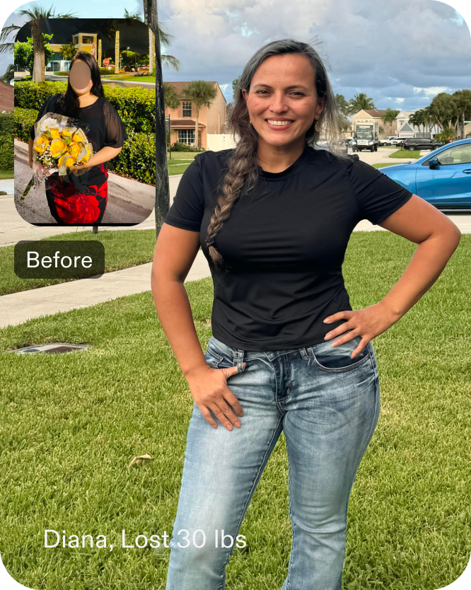 Before and after images of Diana who lost 30 pounds in 6 month through Everself's ESG Stomach Tightening® procedure