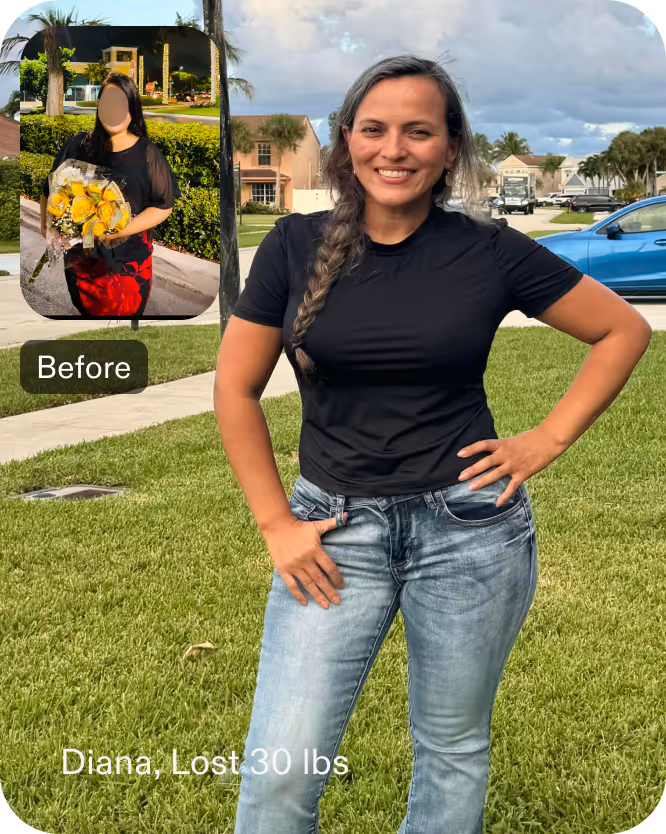 Before and after images of Diana who lost 30 pounds in 6 month through Everself's ESG Stomach Tightening® procedure