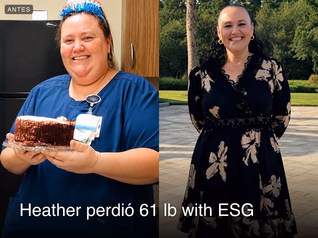 Imagen de antes y después de Heather, quien perdió 61 libras en 5 meses con ESG