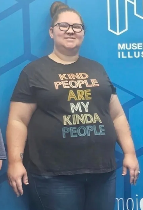 Jaimie before ESG Stomach Tightening
