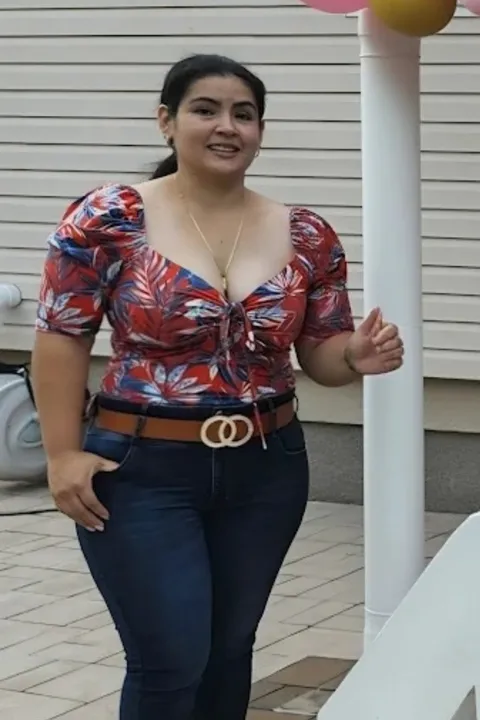 Maria antes de Reducción de Estómago ESG