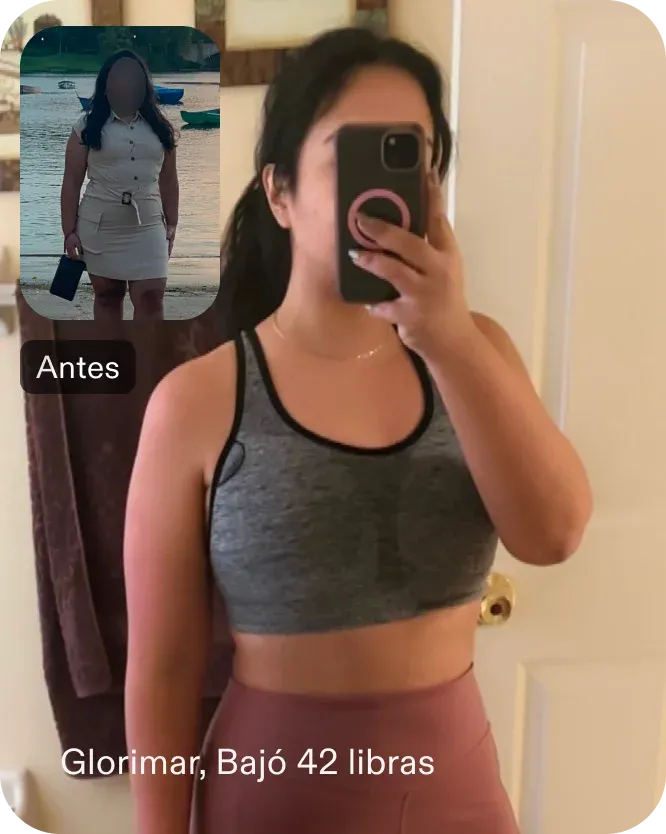 Imágenes de antes y después de Glorimar que perdió 19 kilos con un procedimiento de balón gástrico