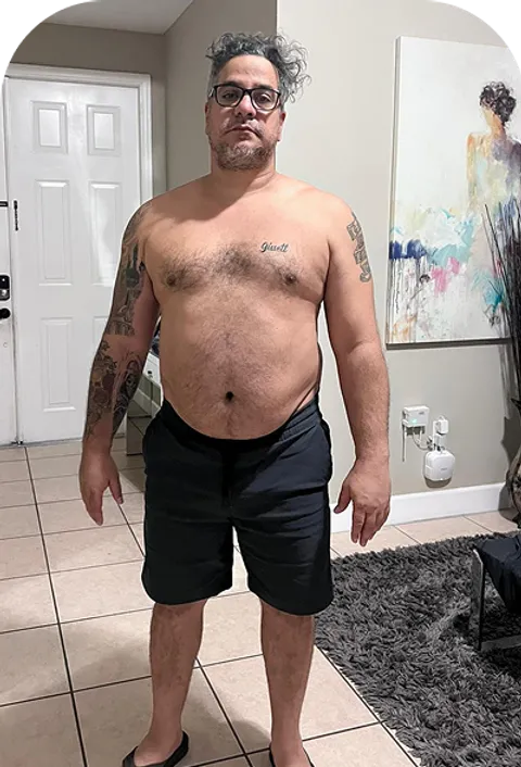 Cesar before ESG Stomach Tightening