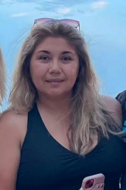 Amelia before ESG Stomach Tightening