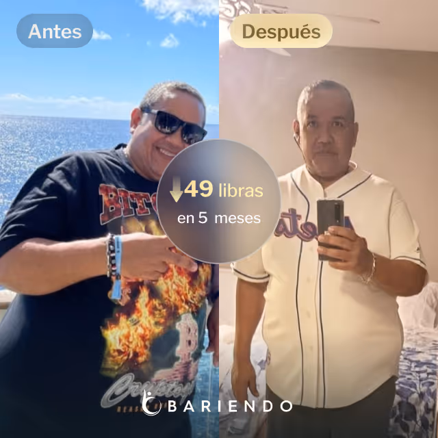 Imágenes de antes y después de César, quien perdió 49 libras en 5 meses mediante el procedimiento ESG Stomach Tightening® de Everself