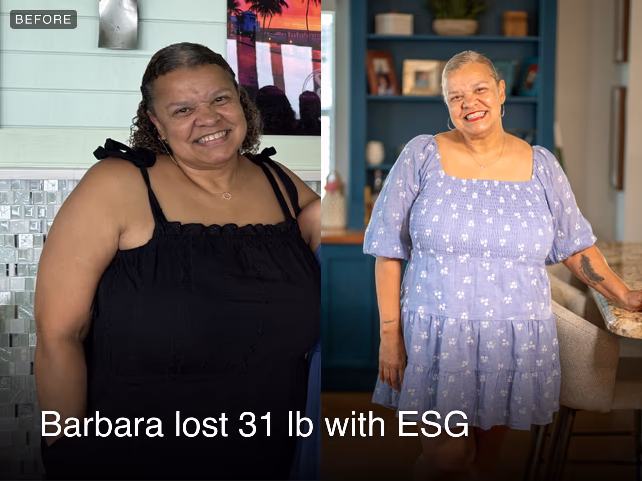 Before and after image of Barbara who lost 31 lbs in 4 months with ESG