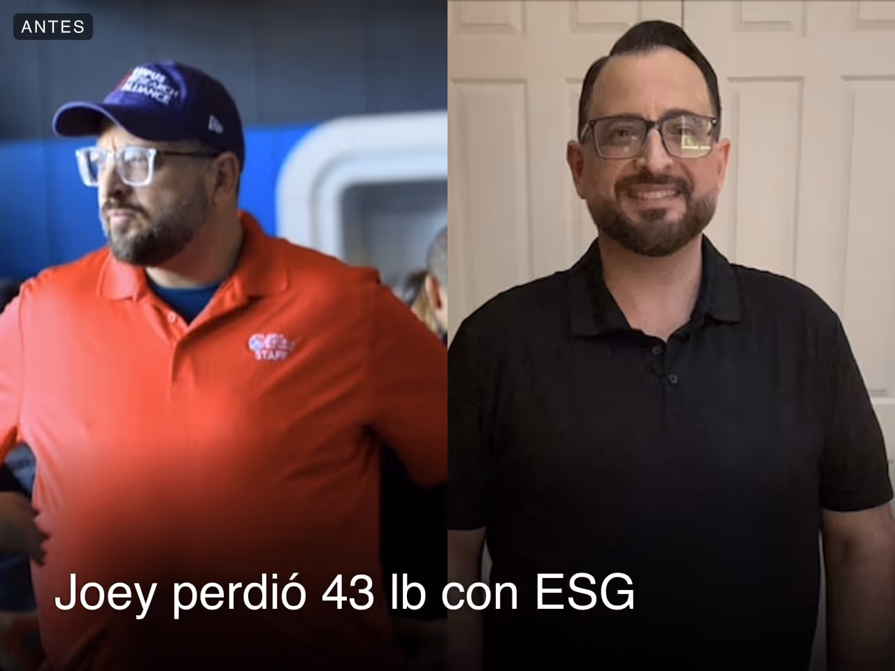 Joey lost 43 lbs with an ESG with Everself
