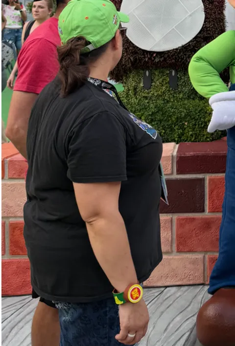 Meagan before ESG Stomach Tightening