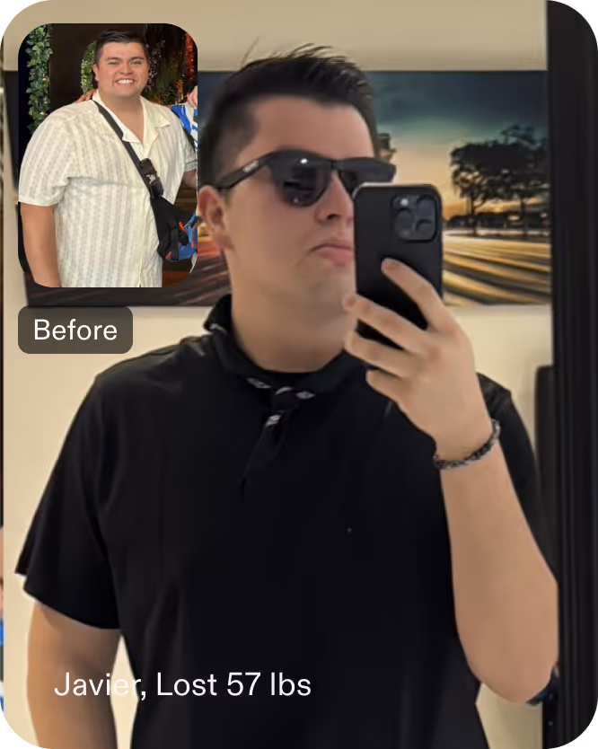 Before and after images of Javier who lost 57 pounds in 8 months after an ESG procedure