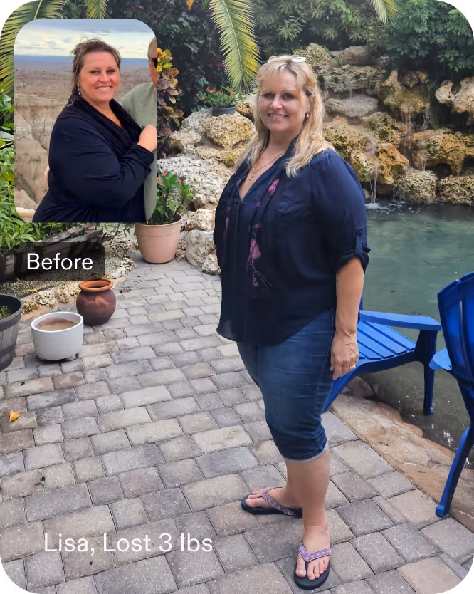 Before and after images of Lisa who lost 42 pounds in 3 months after an ESG procedure