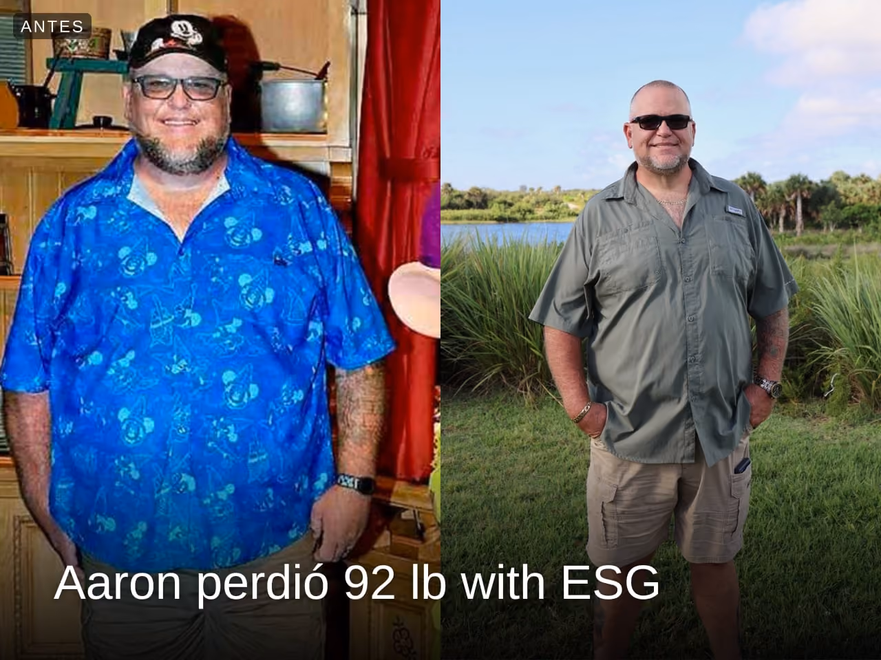 Imagen de antes y después de Aaron, quien perdió 92 libras en 4 meses con ESG