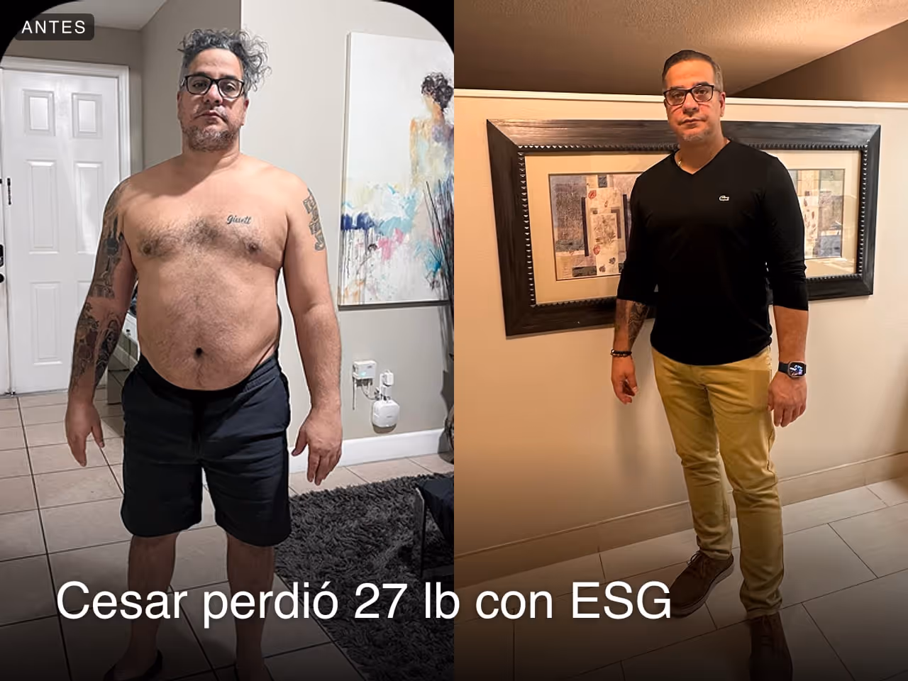 Imágenes de antes y después de César, quien perdió 49 libras en 5 meses gracias al procedimiento de Reducción de Estómago ESG de Everself