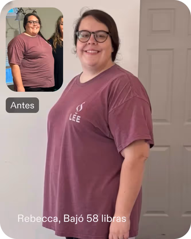 Imágenes de antes y después de Rebecca que perdió 26 kilos con un procedimiento ESG