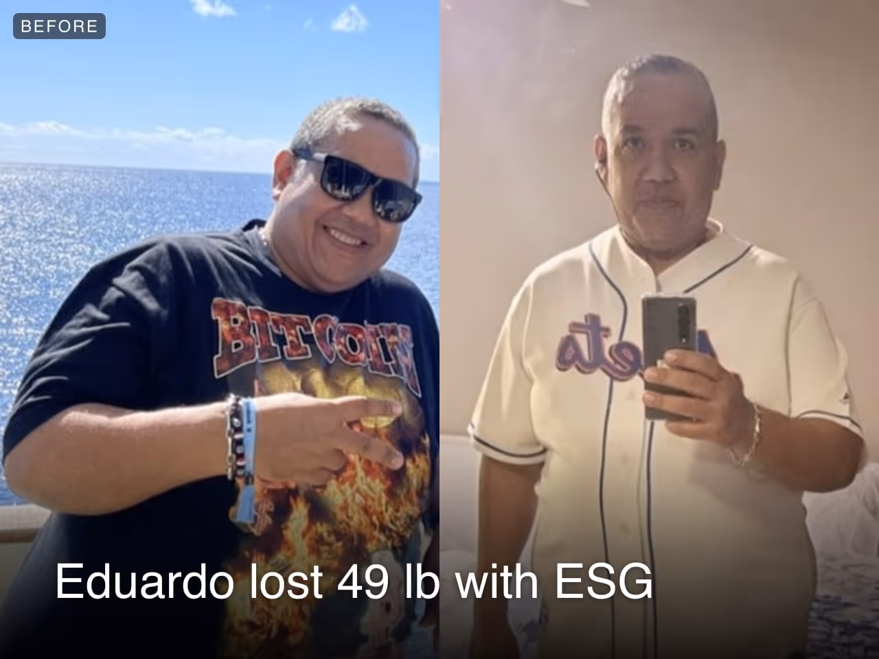 Before and after images of Cesar who lost 49 pounds in 5 months through Everself's ESG Stomach Tightening® procedure