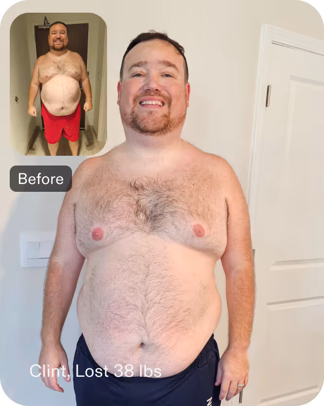 Clint has lost 38 lbs with Everself's revision of sleeve gastrectomy procedure
